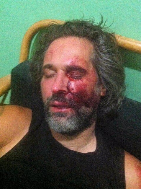 Hunter Hogan after being attacked