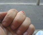 Cut finger