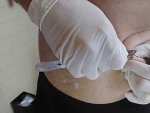 Cutting a mole